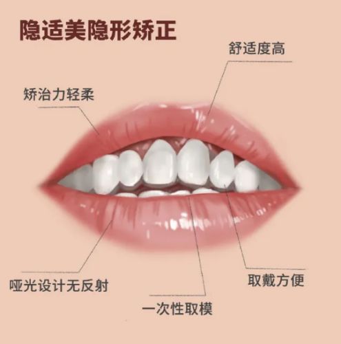 渭南口腔美容：進口種植牙價格與青少年矯正費用