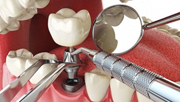http://www.chicagonutritionsolutions.com/d/file/price/ptfue7da23.jpg