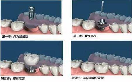http://www.chicagonutritionsolutions.com/d/file/price/q2m5ybdqv1rd.jpg