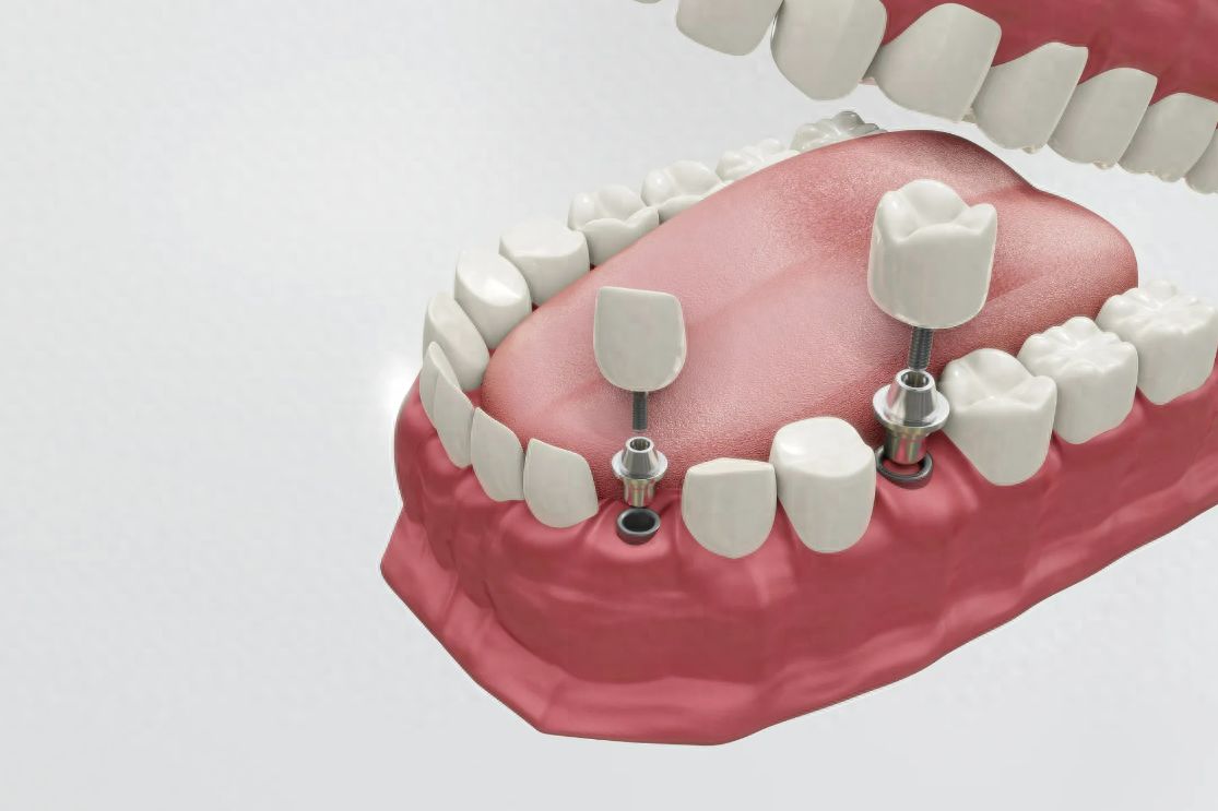 http://www.chicagonutritionsolutions.com/d/file/price/qa7dhiplsnj7.jpg