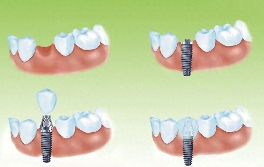 http://www.chicagonutritionsolutions.com/d/file/price/qct1y3rbjbi0.jpg