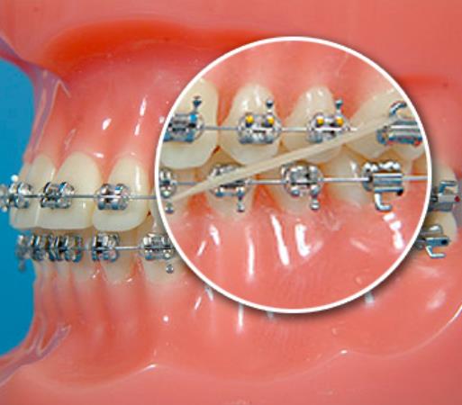 http://www.chicagonutritionsolutions.com/d/file/price/r1z37sf40p.jpg