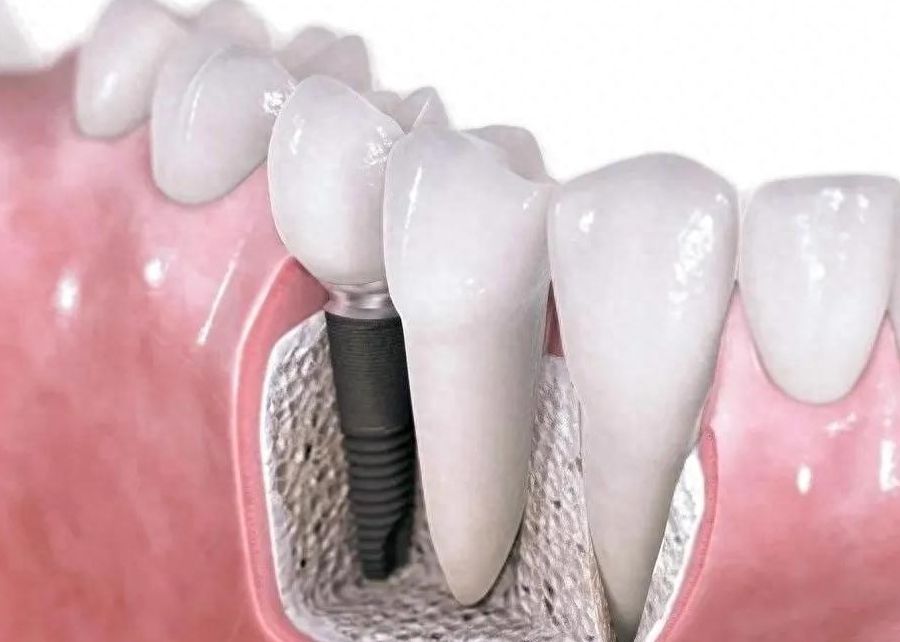 http://www.chicagonutritionsolutions.com/d/file/price/r6gv92tbsh5l.jpg