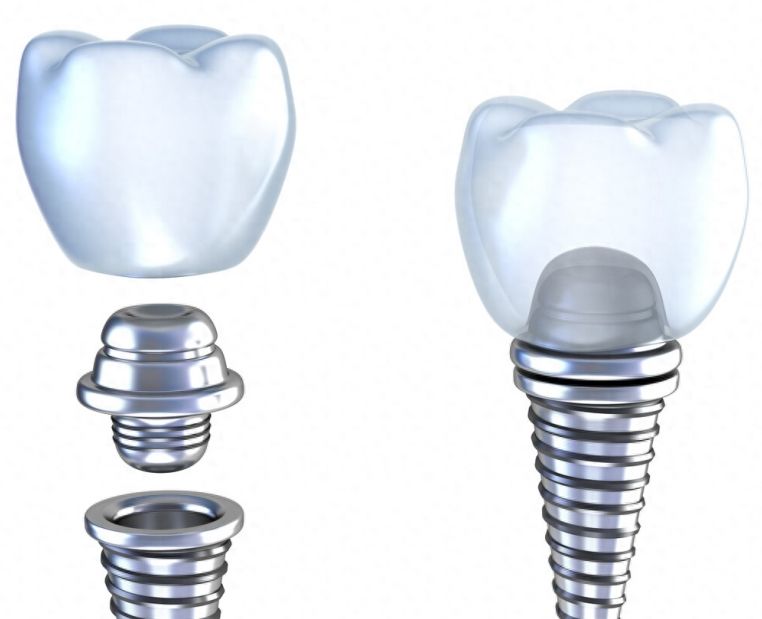 http://www.chicagonutritionsolutions.com/d/file/price/r6irmic5m3u0.jpg