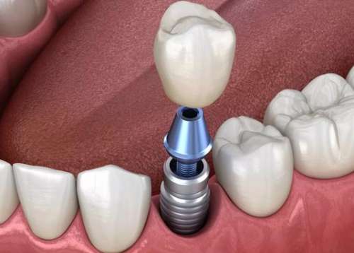 http://www.chicagonutritionsolutions.com/d/file/price/r6r961nnms.jpg