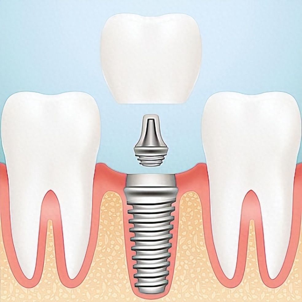 http://www.chicagonutritionsolutions.com/d/file/price/ra2qrky5gnek.jpg