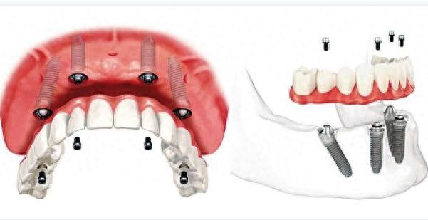 http://www.chicagonutritionsolutions.com/d/file/price/rbgidb12dx5v.jpg