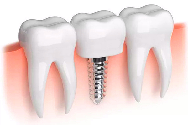 http://www.chicagonutritionsolutions.com/d/file/price/rf6uzd6vzd28.jpg