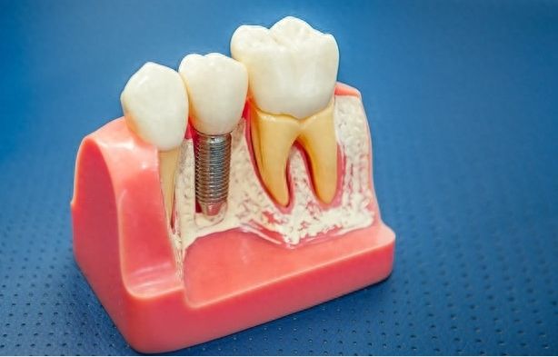 http://www.chicagonutritionsolutions.com/d/file/price/ridwpir51478.jpg