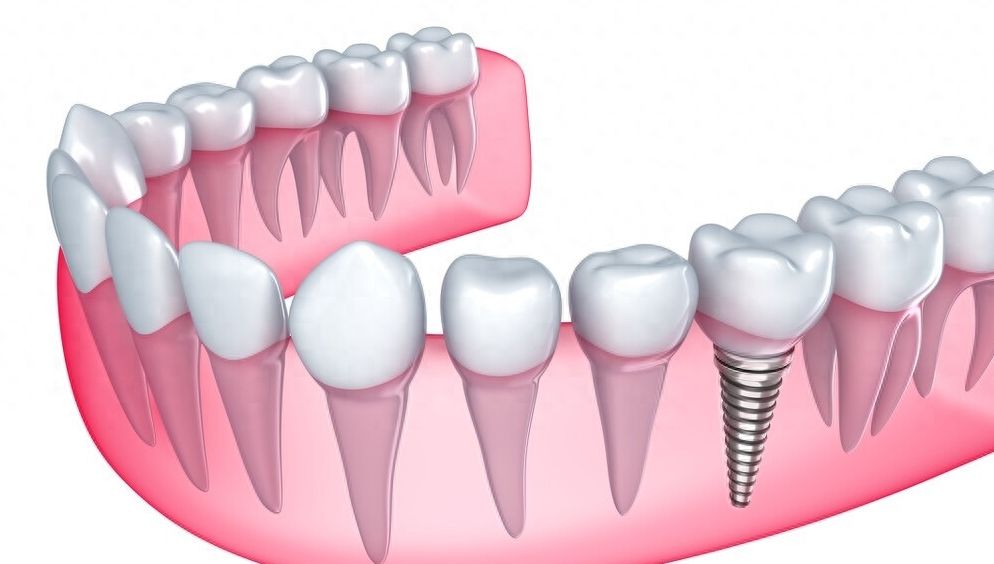 http://www.chicagonutritionsolutions.com/d/file/price/s3g0aqbykcp6.jpg