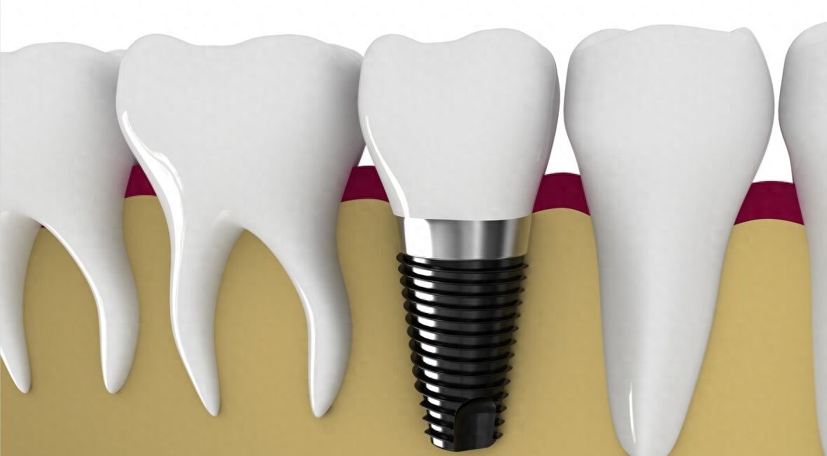 http://www.chicagonutritionsolutions.com/d/file/price/s4r5qfex6q.jpg