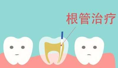 詳解：氧化鋁全瓷牙與二氧化鋯全瓷牙，一顆多少錢？