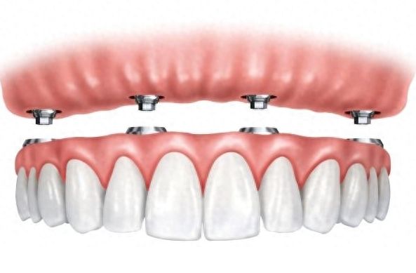 http://www.chicagonutritionsolutions.com/d/file/price/sl4imlzusxk3.jpg