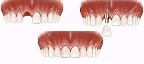 http://www.chicagonutritionsolutions.com/d/file/price/sozflwbbwxdp.jpg