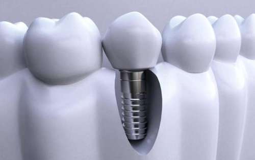 http://www.chicagonutritionsolutions.com/d/file/price/sr7y735rswv4.jpg