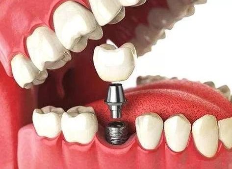 http://www.chicagonutritionsolutions.com/d/file/price/sxb6cecep9ga.jpg