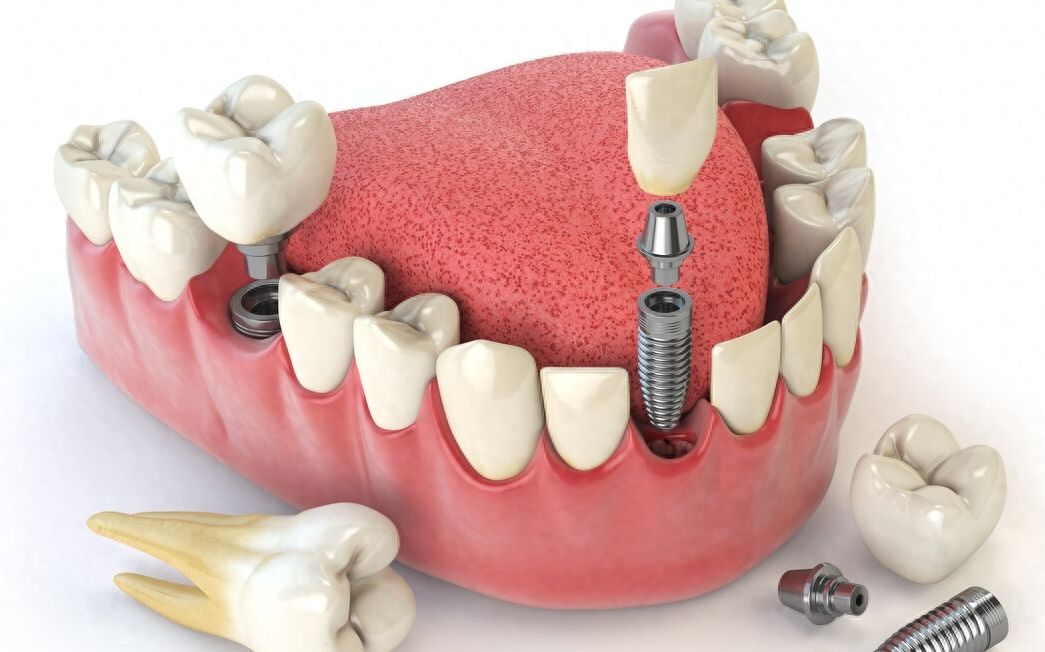 http://www.chicagonutritionsolutions.com/d/file/price/t4j5s4f57xv0.jpg