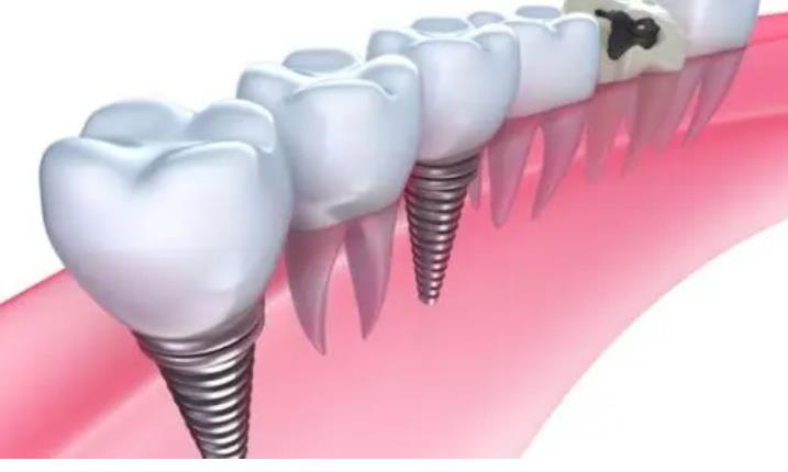 http://www.chicagonutritionsolutions.com/d/file/price/tlx3qcljy0lp.jpg
