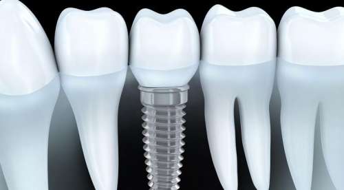 http://www.chicagonutritionsolutions.com/d/file/price/tux99lc90wjh.jpg