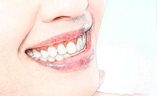 http://www.chicagonutritionsolutions.com/d/file/price/tziroz9amxna.jpg