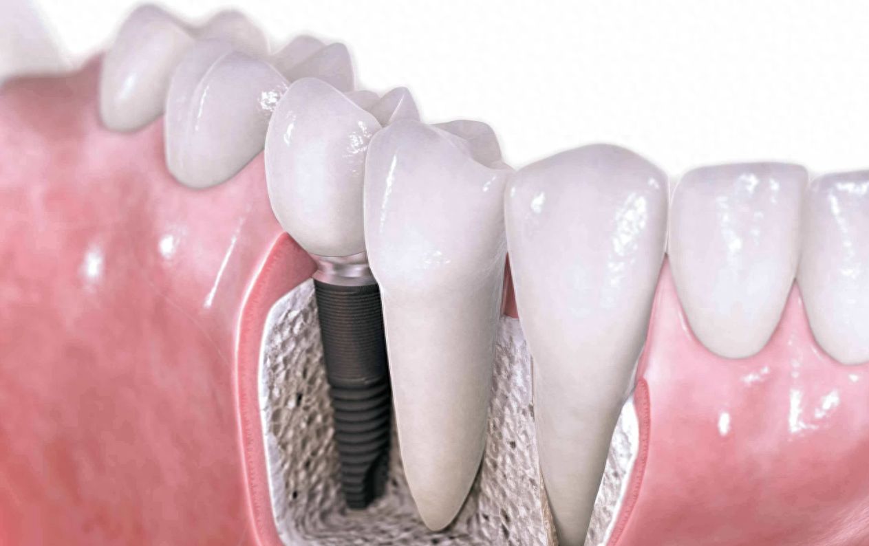 http://www.chicagonutritionsolutions.com/d/file/price/u1q655mip2p1.jpg