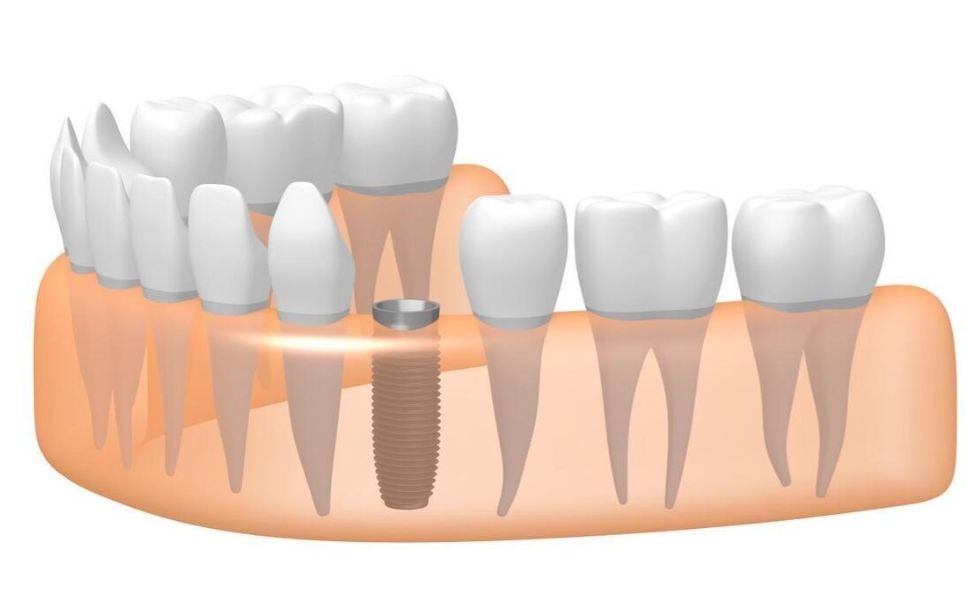 http://www.chicagonutritionsolutions.com/d/file/price/uarodvia6uh4.jpg