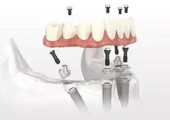 http://www.chicagonutritionsolutions.com/d/file/price/um0mfa647zd1.jpg