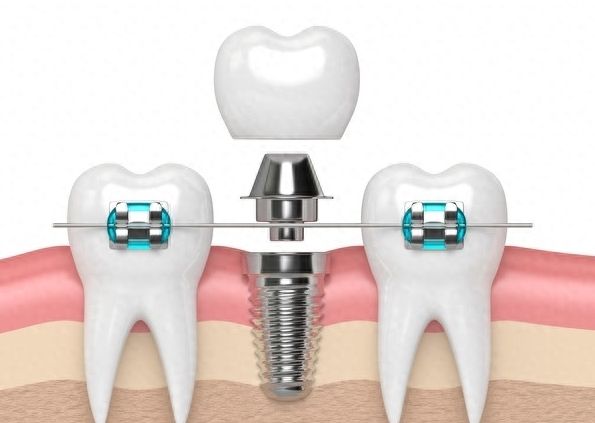 http://www.chicagonutritionsolutions.com/d/file/price/uokcqja2q29o.jpg