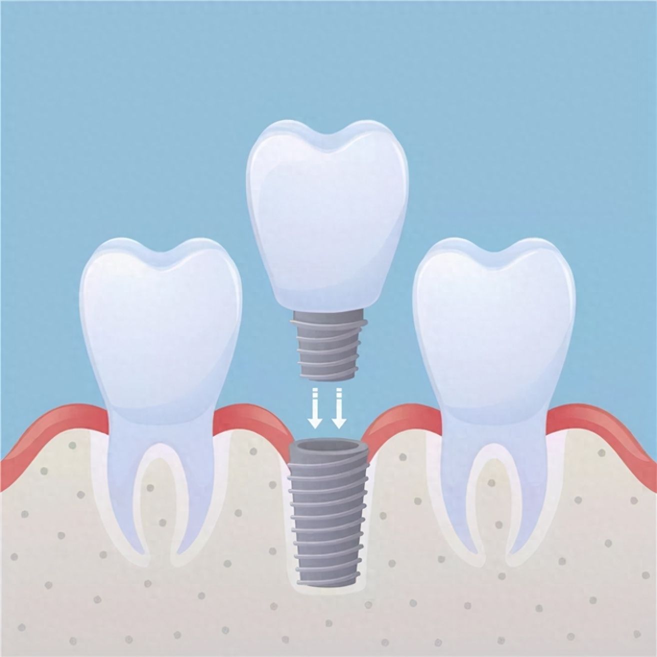http://www.chicagonutritionsolutions.com/d/file/price/usudivyxr81y.jpg