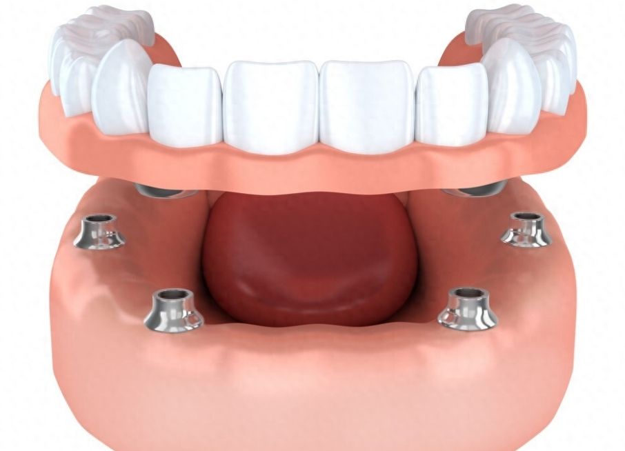 http://www.chicagonutritionsolutions.com/d/file/price/v11d4s2ifrwc.jpg