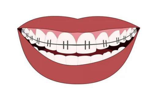 http://www.chicagonutritionsolutions.com/d/file/price/v4n163tl15ea.jpg