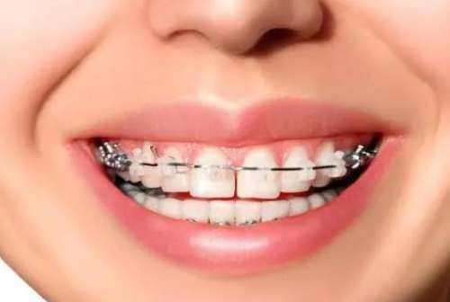http://www.chicagonutritionsolutions.com/d/file/price/v8mj6s4cnsal.jpg