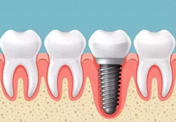 http://www.chicagonutritionsolutions.com/d/file/price/vaixe43aspbl.jpg