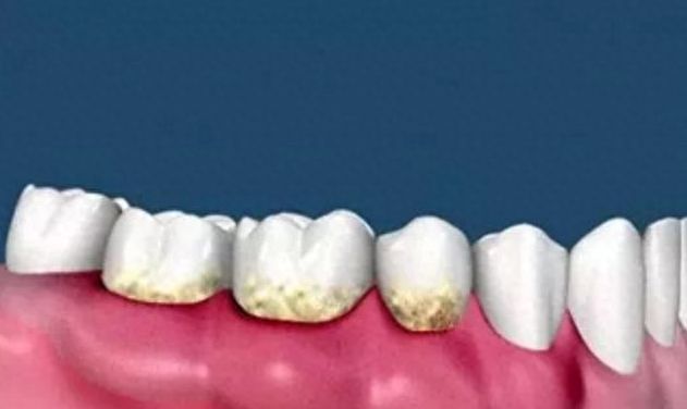 http://www.chicagonutritionsolutions.com/d/file/price/vgkeqxf6gxr5.jpg