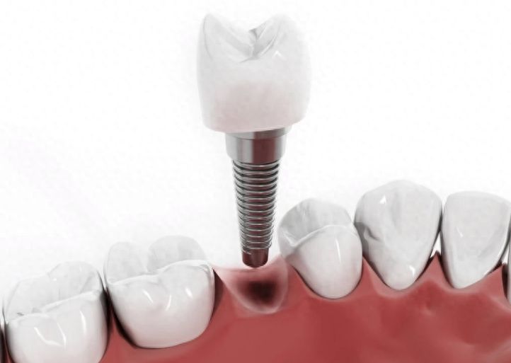 http://www.chicagonutritionsolutions.com/d/file/price/vwm00tok00m6.jpg