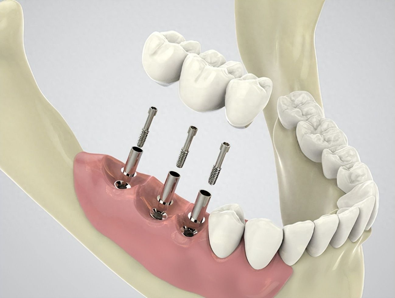 http://www.chicagonutritionsolutions.com/d/file/price/wa1rtqiddjii.jpg