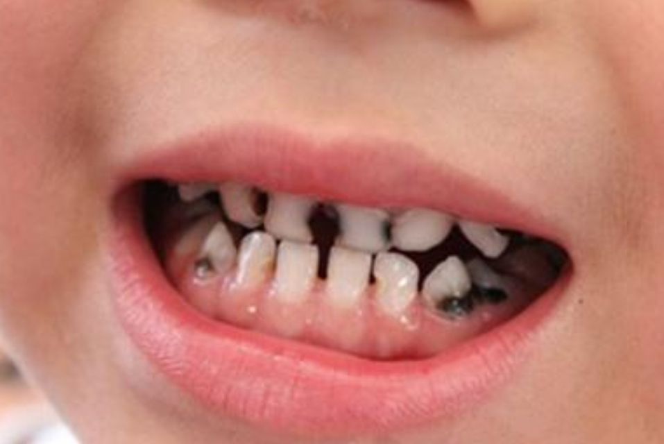 http://www.chicagonutritionsolutions.com/d/file/price/wbm4tj6ndqyu.jpg