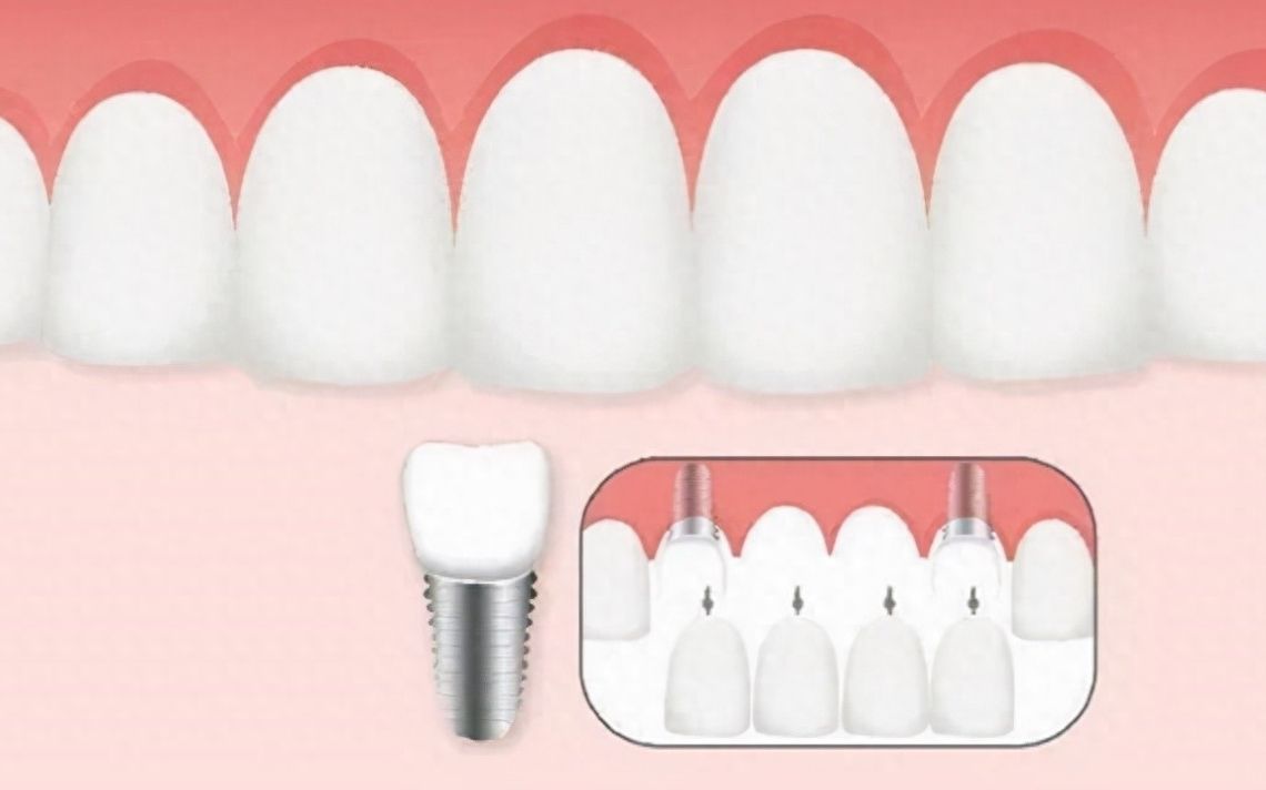 http://www.chicagonutritionsolutions.com/d/file/price/wpgqlflb3rj4.jpg