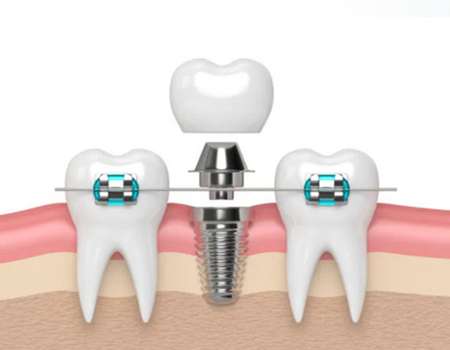 http://www.chicagonutritionsolutions.com/d/file/price/x7j7k19losxf.jpg