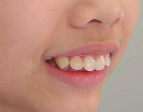 http://www.chicagonutritionsolutions.com/d/file/price/ya304gbus1.jpg