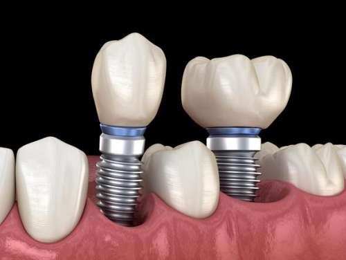 http://www.chicagonutritionsolutions.com/d/file/price/ytflwt8vrsn9.jpg