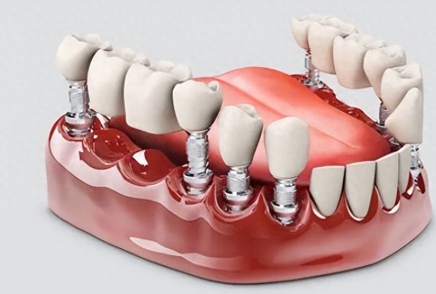 http://www.chicagonutritionsolutions.com/d/file/price/z06h8yhiorpi.jpg
