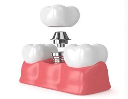 http://www.chicagonutritionsolutions.com/d/file/price/z0pjbpsk3nuk.jpg