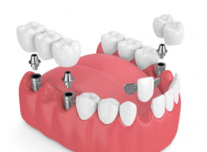 http://www.chicagonutritionsolutions.com/d/file/price/z2wrlk4wqazw.jpg