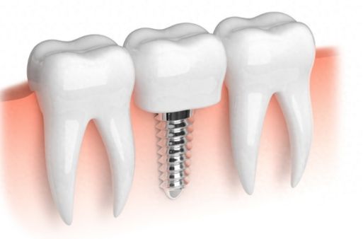 http://www.chicagonutritionsolutions.com/d/file/price/z4fh8hwzhnov.jpg