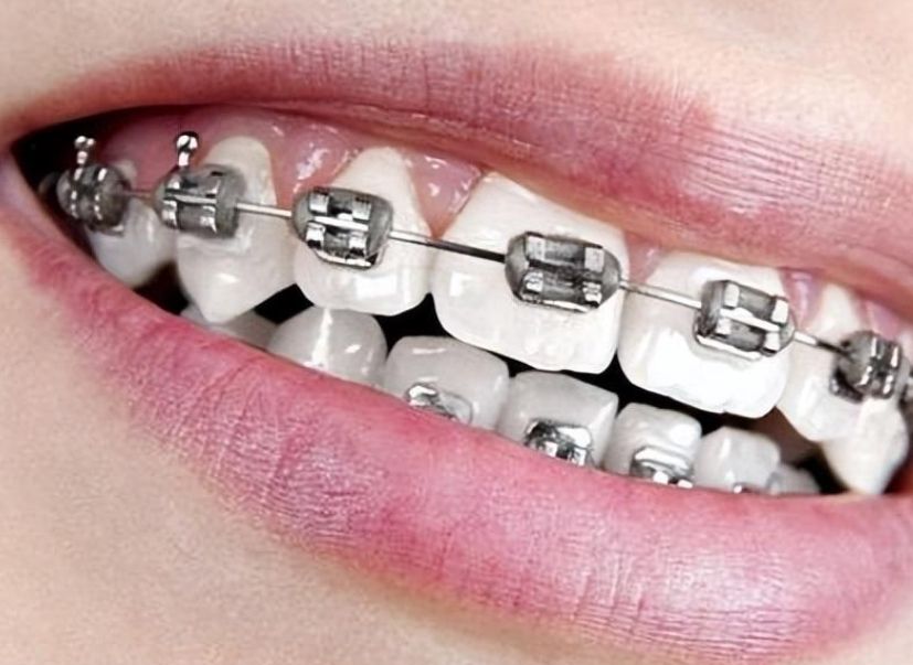 http://www.chicagonutritionsolutions.com/d/file/price/z9dr20km9ram.jpg