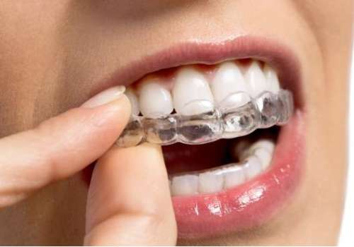 http://www.chicagonutritionsolutions.com/d/file/price/zgs95cg2g01w.jpg