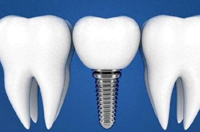 http://www.chicagonutritionsolutions.com/d/file/price/zhkzqyyqycoj.jpg