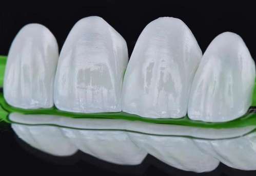 http://www.chicagonutritionsolutions.com/d/file/price/zs441h94sk26.jpg