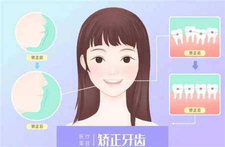 南昌虹橋口腔門診口碑大起底：專家測(cè)評(píng)，案例展示